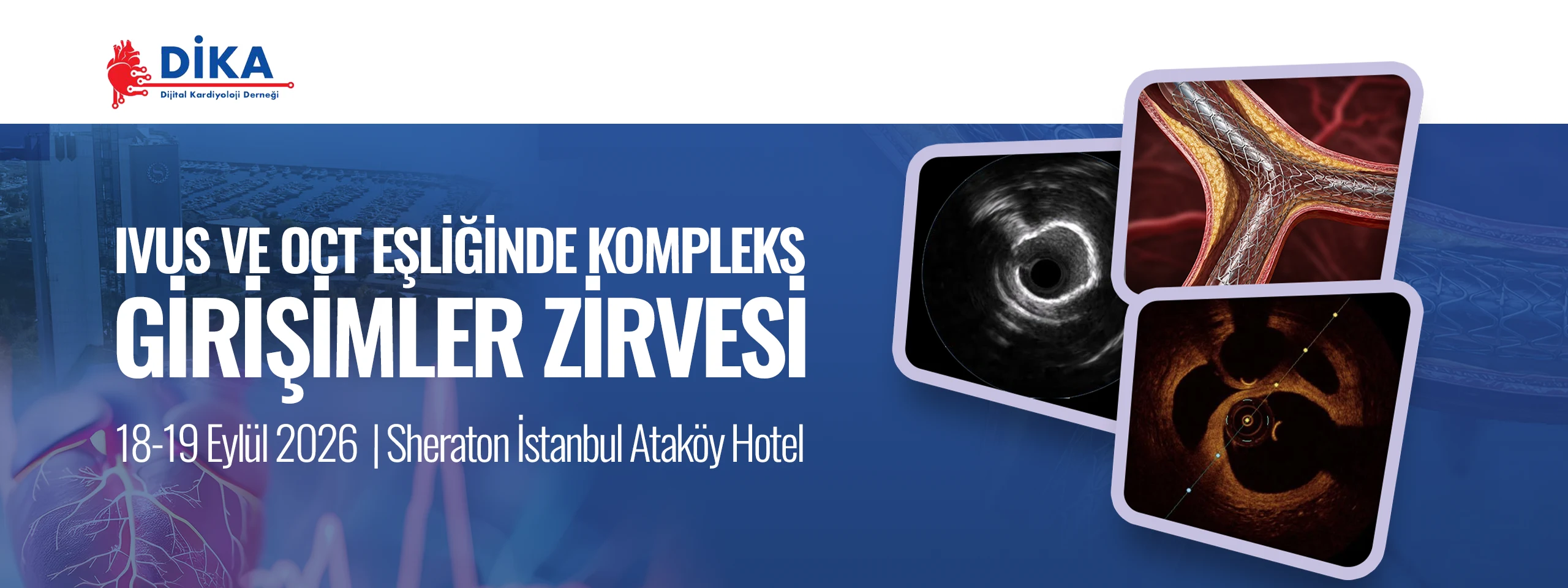 IVUS ve OCT Eşliğinde Kompleks Girişimler Zirvesi — 18-19 Eylül 2026, Sheraton İstanbul Ataköy Hotel