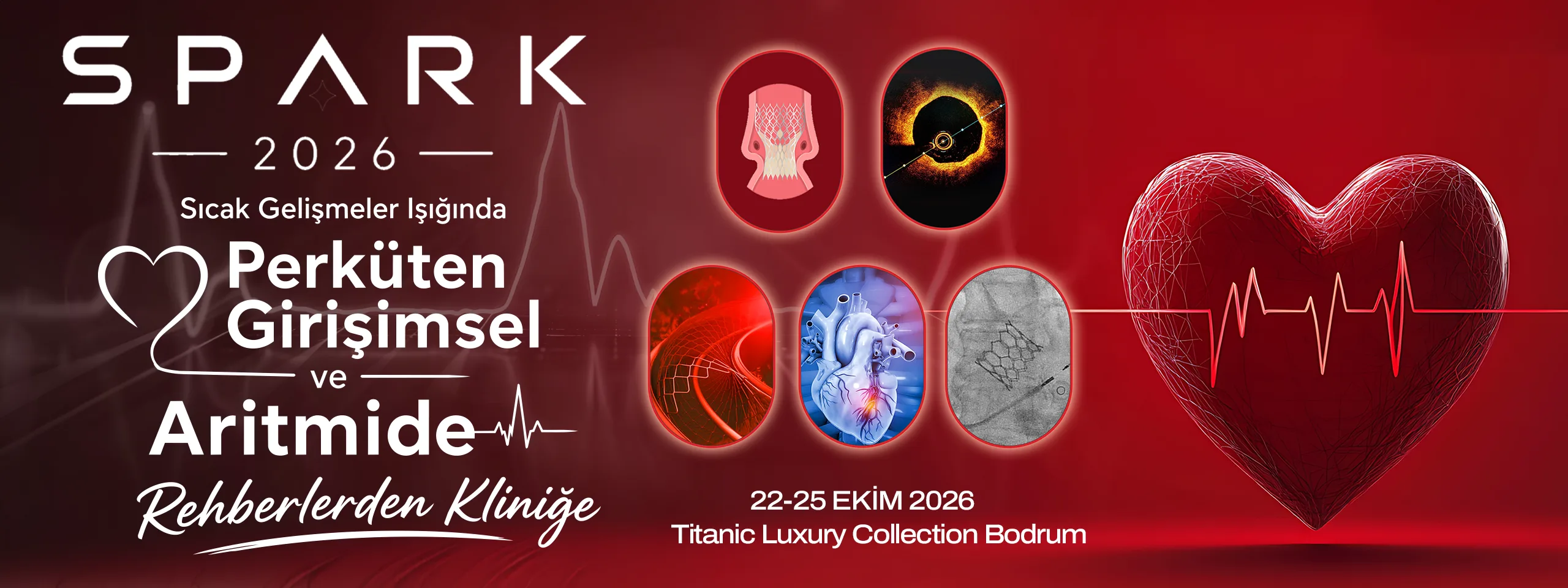 SPARK 2026 — Sıcak Gelişmeler Işığında Perkütan Girişimsel ve Aritmide Rehberlerden Kliniğe. 22-25 Ekim 2026, Titanic Luxury Collection Bodrum.